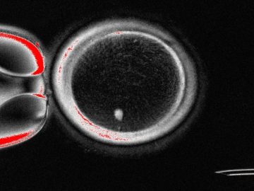 MAROKO133 Hot ai: Human skin cells transformed into eggs in embryo study, fueling fertilit