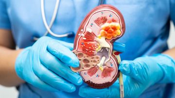 MAROKO133 Eksklusif kesehatan: Begini Perubahan Warna Urine yang Menandakan Gagal Ginjal W