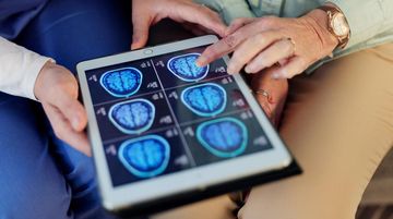 MAROKO133 Eksklusif kesehatan: Neurolog: Jangan Remehkan Sakit Kepala Seperti Ini, Bisa Ja