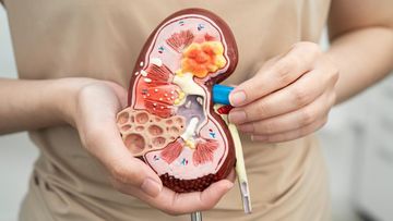 MAROKO133 Hot kesehatan: 6 Makanan-Minuman yang Sebaiknya Dihindari Kalau Mau Ginjal Tetap