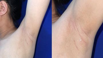 MAROKO133 Update kesehatan: Viral Kondisi Langka ASI Keluar dari Ketiak, Dokter: Nggak Nor