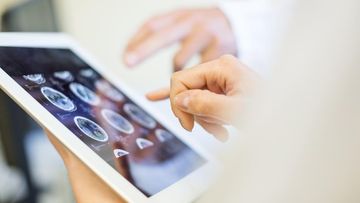 MAROKO133 Breaking kesehatan: Pria Lebih Berisiko Alami Kanker Otak Akibat Polusi Udara, I