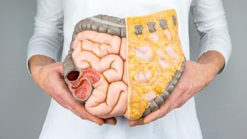 MAROKO133 Hot kesehatan: Bukan Cuma UPF! Onkolog Ungkap Makanan Ini Berisiko Picu Kanker U